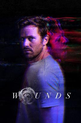 Wounds stream